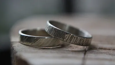 Can Stainless Steel Turn Your Skin Green?